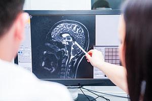 Poor nutrition hampers traumatic brain injury recovery